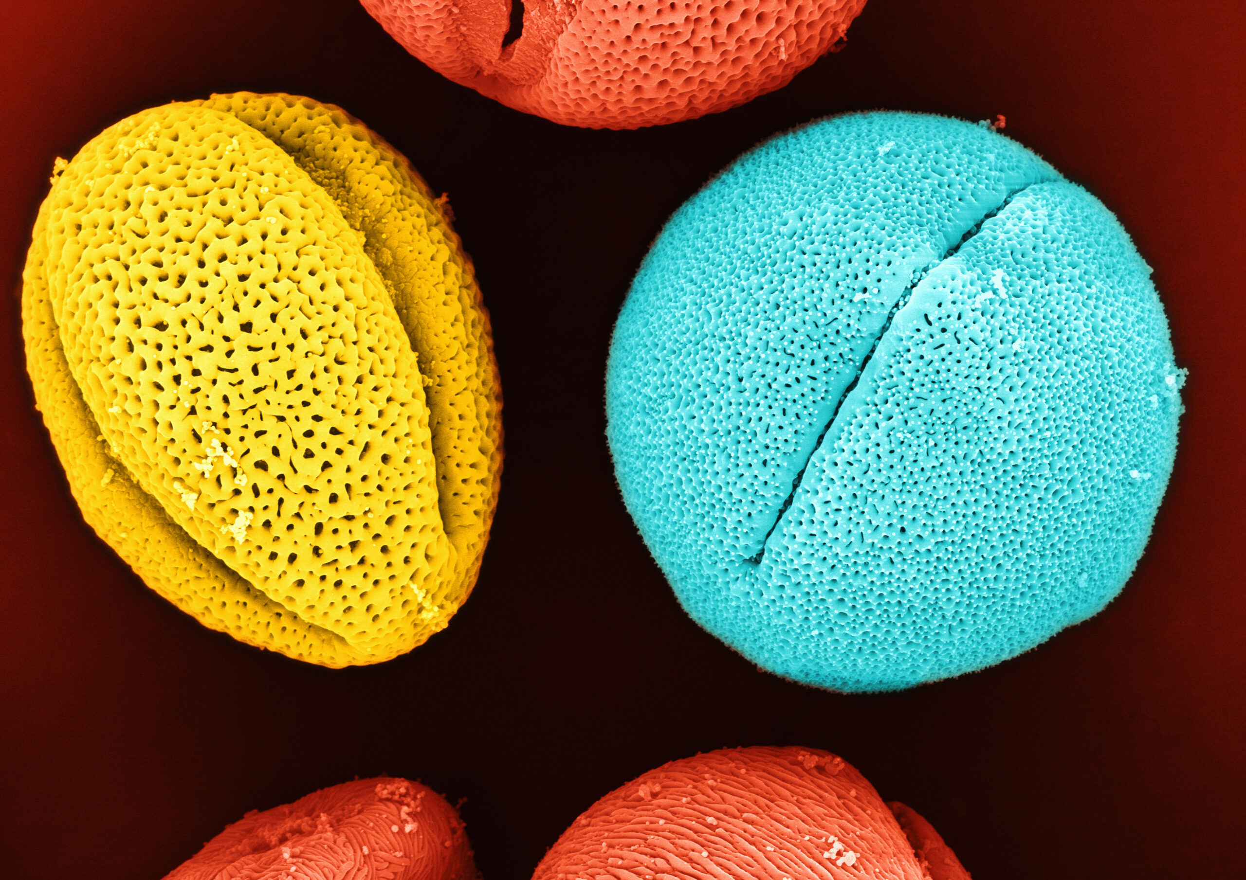 Printemps déprimant : Le rhume des foins sabote votre cerveau de l’intérieur